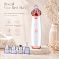 Electric Blackhead Remover